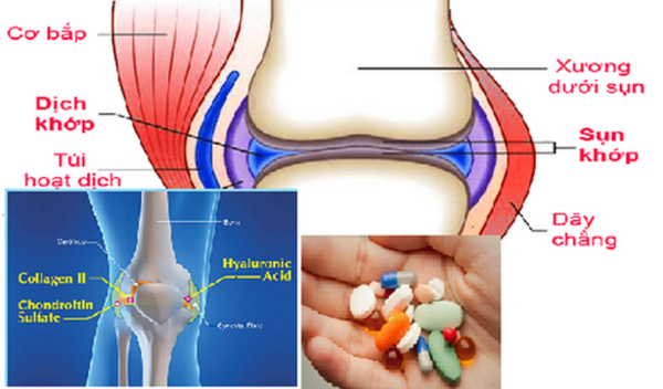 Một số bất lợi khi dùng thuốc “bổ khớp”