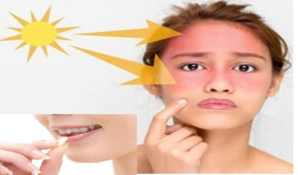 Thực hư tác dụng của viên uống chống nắng