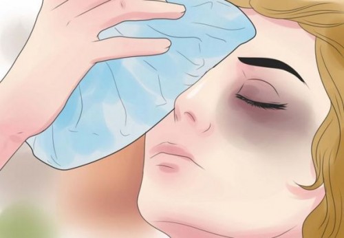 Xử trí và phòng ngừa một số tai nạn mắt tại nhà