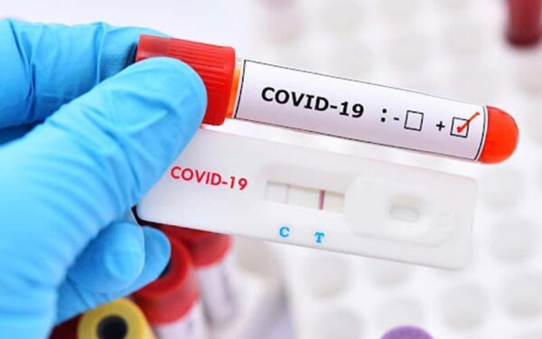 Test nhanh COVID-19 tại nhà, vạch đậm có phải bệnh nặng?