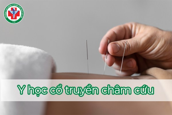 Y học cổ truyền châm cứu là gì? Hoạt động như thế nào? Có tác dụng gì?