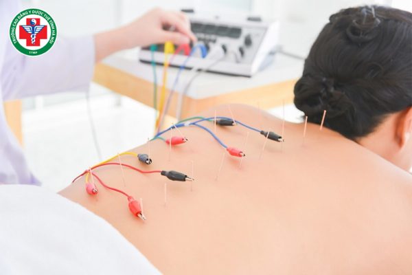 Điện châm là gì? Đối tượng, tác dụng, cách tiến hành và lưu ý