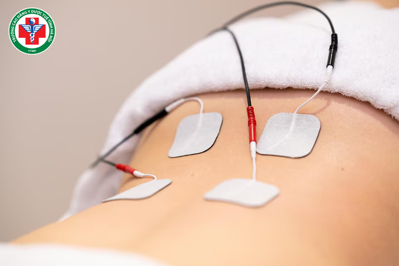 Điện xung trong vật lý trị liệu kích thích hệ thần kinh thông qua bề mặt da
