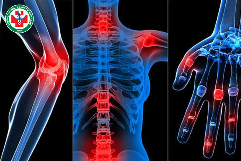 Điện xung trị liệu cải thiện chức năng của hệ cơ, thần kinh và mạch máu