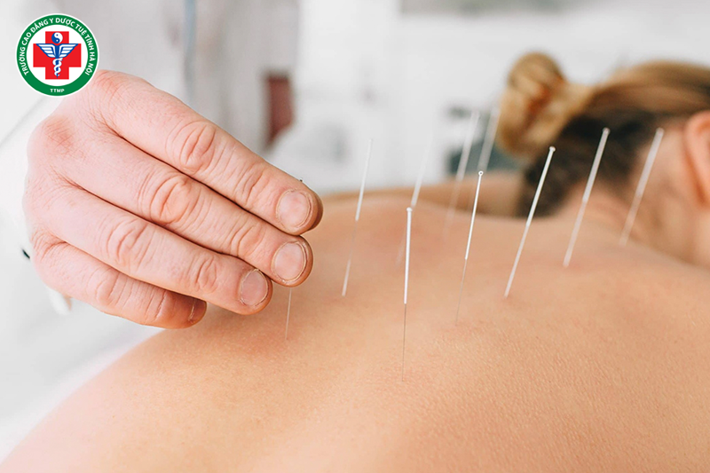 Y học cổ truyền thiên về các phương pháp trị liệu tự nhiên