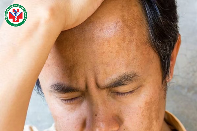 Quan sát màu sắc da mặt để định hướng chứng trạng