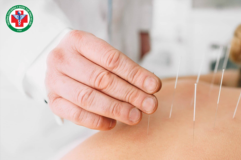 Tứ chẩn là kim chỉ nam trong châm cứu