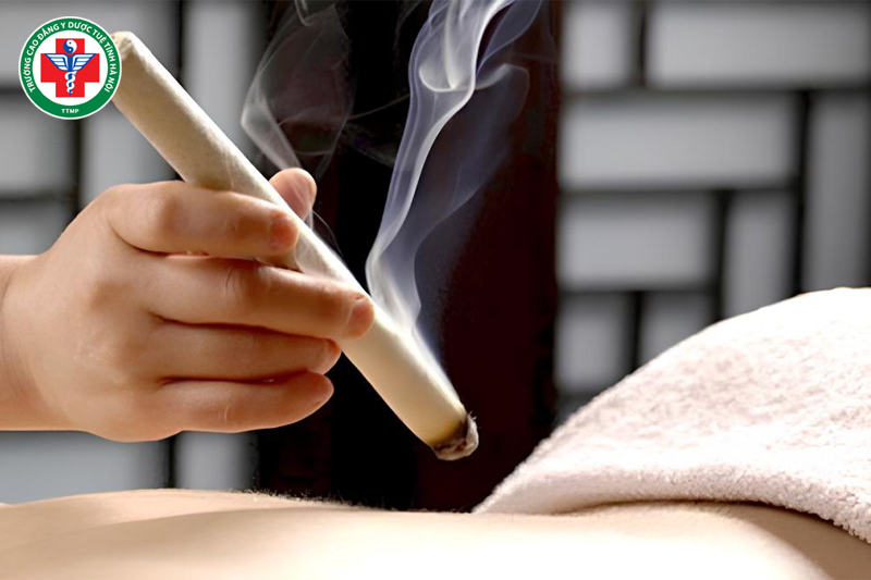 Cứu ngải trong Y học cổ truyền: Nguyên lý, tác dụng và ứng dụng trong điều trị bệnh