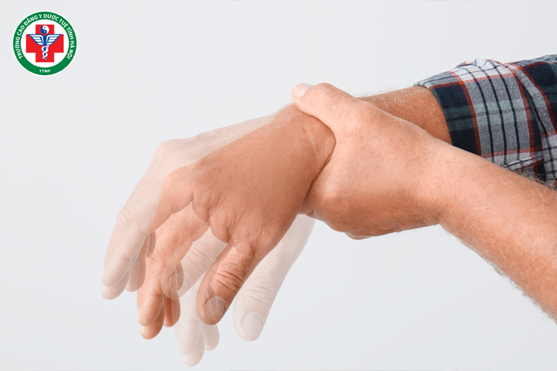 Can phong nội động run tay