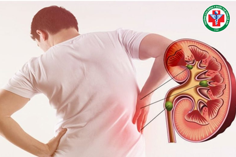 Tạng thận trong Y học cổ truyền – Vai trò, chức năng và cách bảo vệ thận