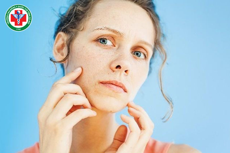 Chính khí suy yếu khiến Da xanh xao hoặc nhợt nhạt