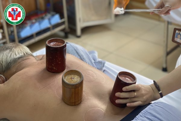 Giác hơi trong Y học cổ truyền: Cơ chế tác động, công dụng và quy trình thực hiện