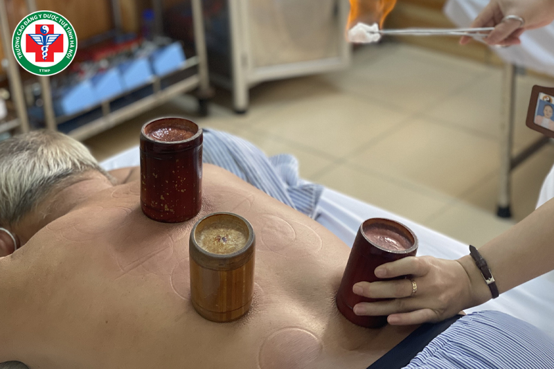 Giác hơi trong Y học cổ truyền: Cơ chế tác động, công dụng và quy trình thực hiện