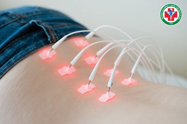 Laser châm là gì? Nguyên lý, công dụng và ứng dụng trong điều trị hiện đại