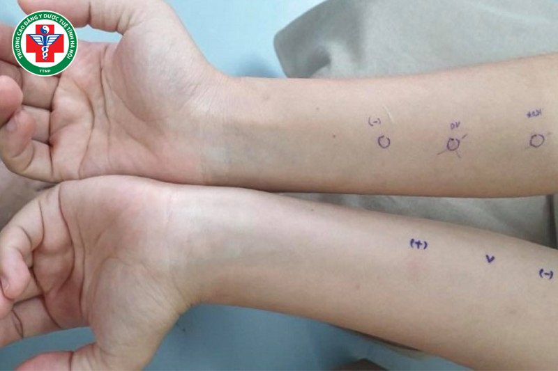 Mạch phù là gì? Ý nghĩa và cách nhận biết trong Y học cổ truyền