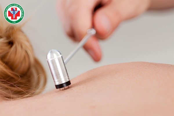 Mai hoa châm là gì? Công dụng và ứng dụng trong Y học cổ truyền