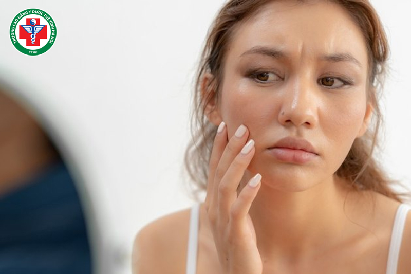 Huyết hư khiến sắc mặt nhợt nhạt, thiếu sức sống