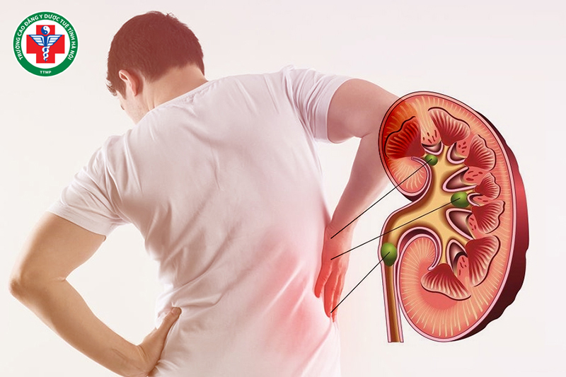 Nếu Can âm hư kéo dài mà không điều trị, bệnh có thể lan sang Thận