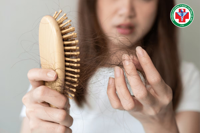Can huyết hư khiến da khô, tóc rụng nhiều