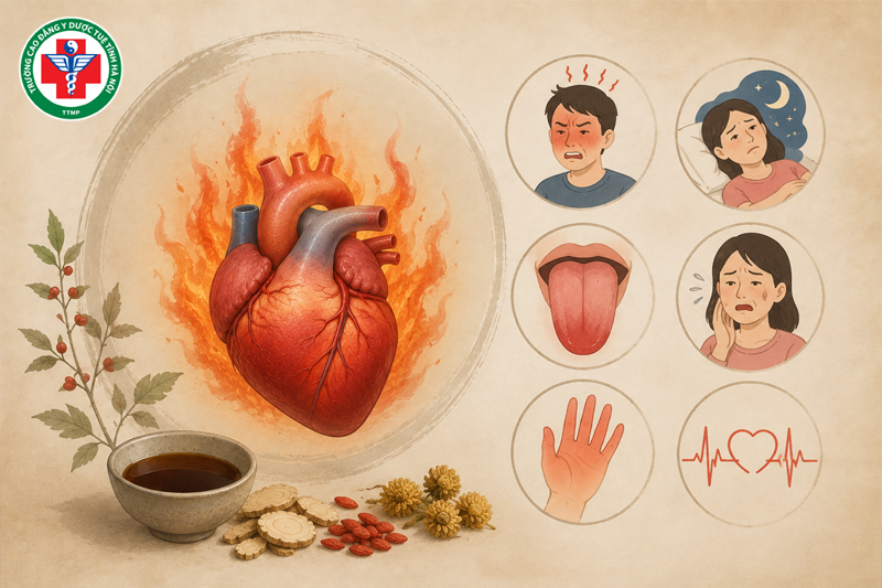 Tâm hỏa vượng là gì? Nguyên nhân, triệu chứng và cách điều trị Đông y
